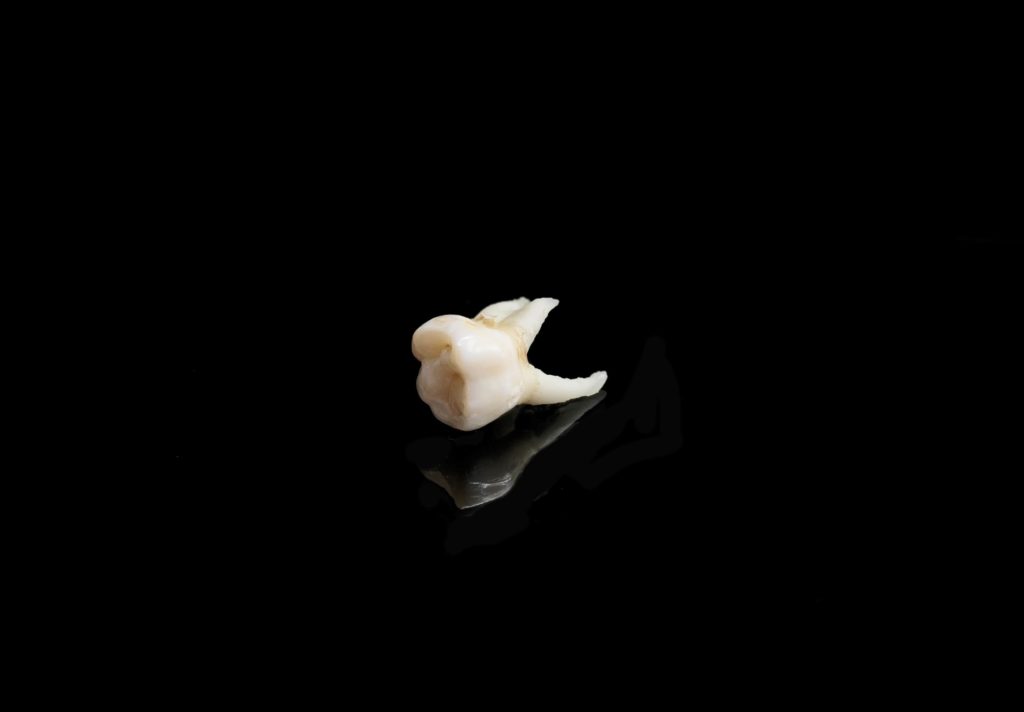 Image of white tooth on black background representing tooth extraction services from Normandy Dental and Lakewood Dental in Jacksonville Florida